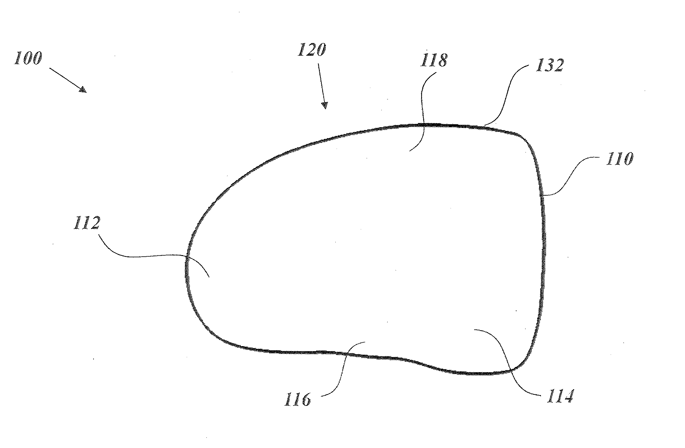 Implantable prosthesis