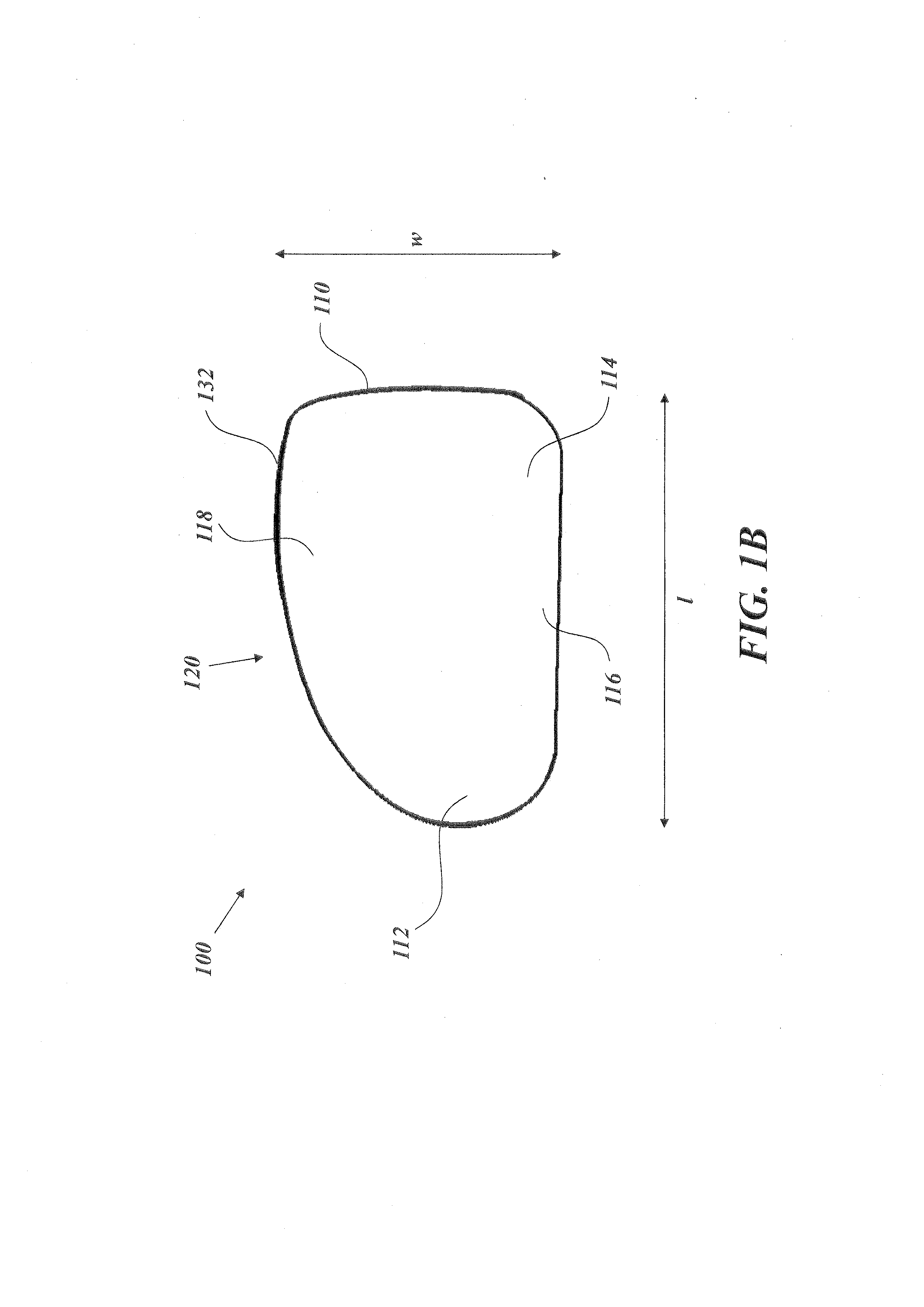 Implantable prosthesis