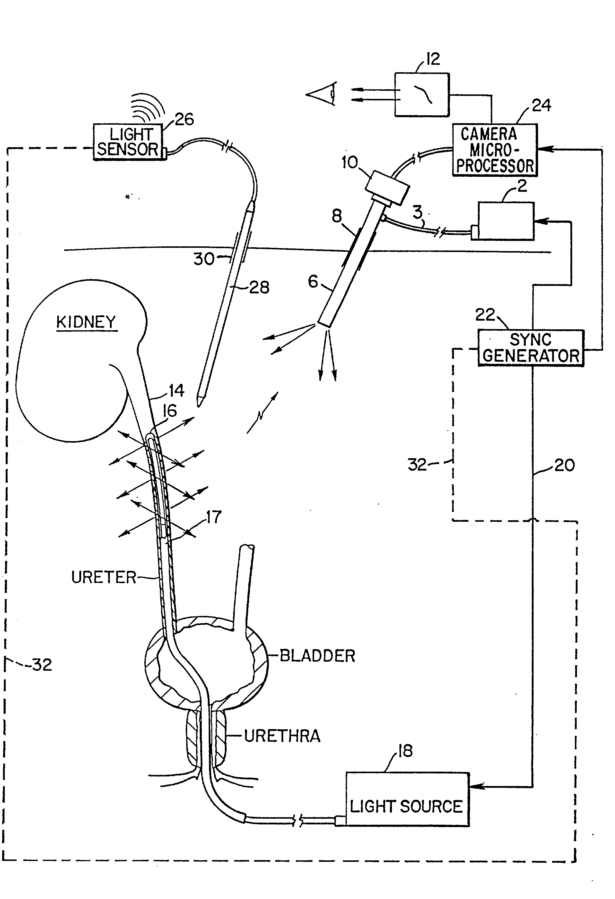 Transillumination of body members for protection during body invasive procedures