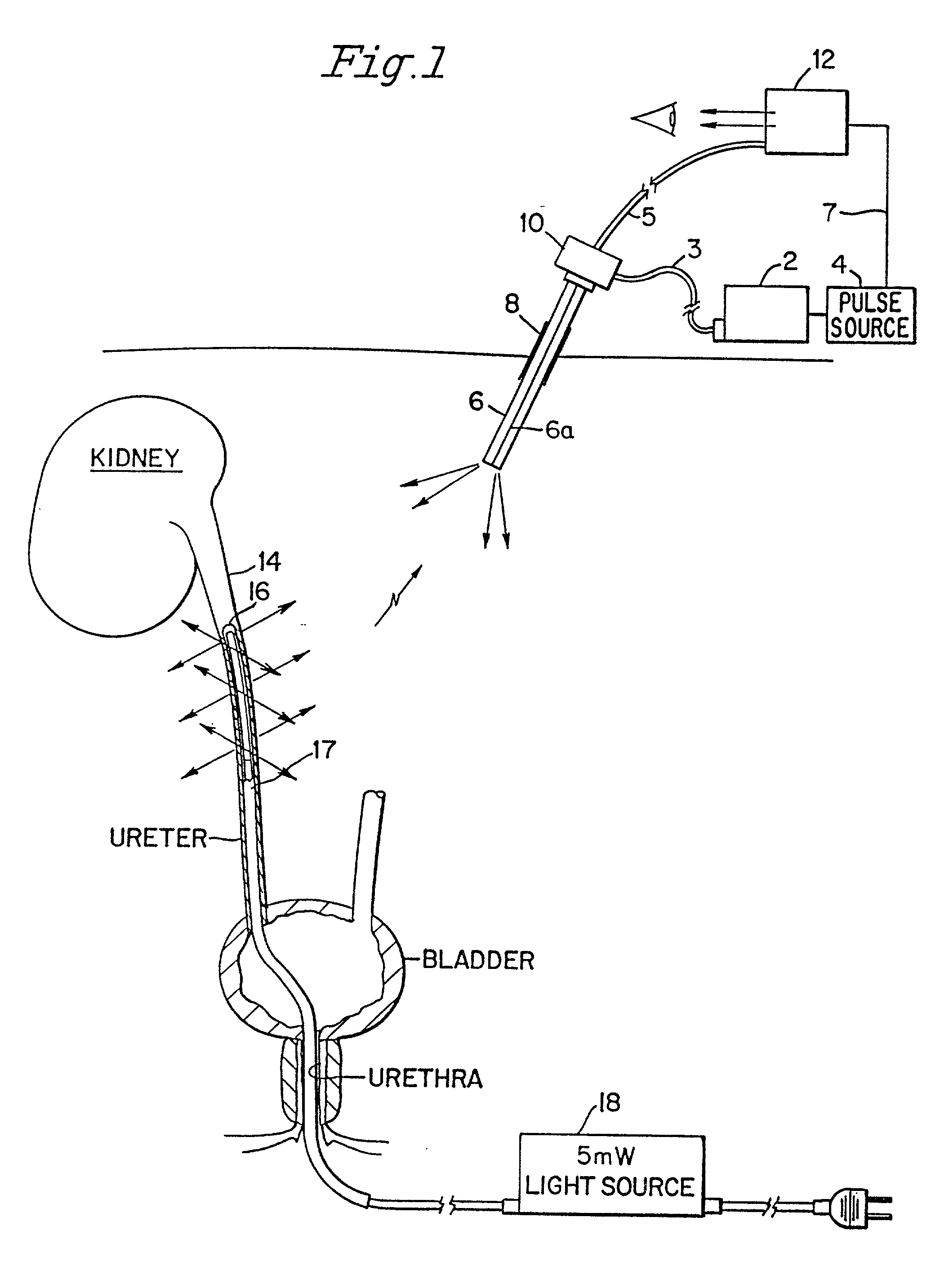 Transillumination of body members for protection during body invasive procedures