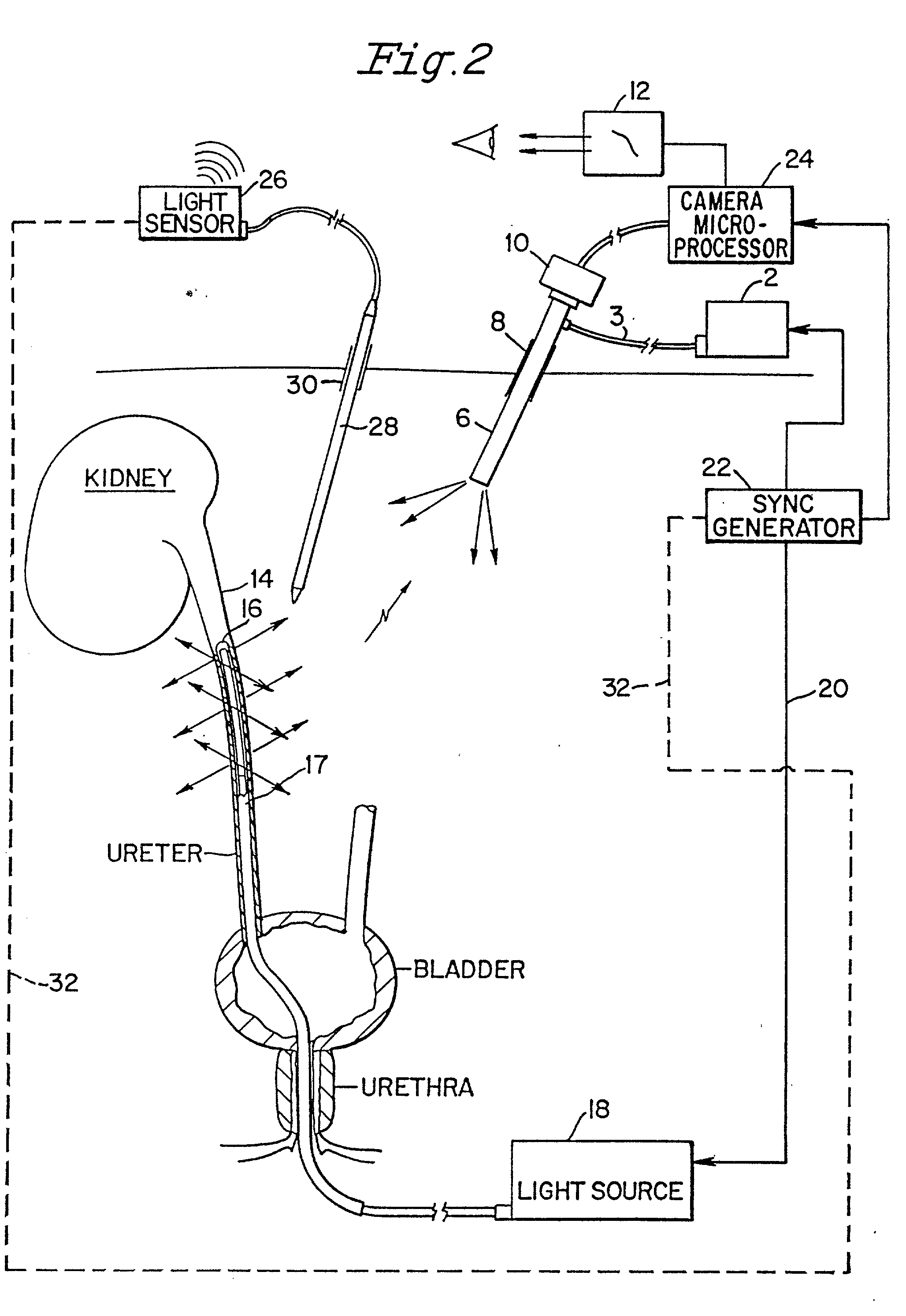 Transillumination of body members for protection during body invasive procedures