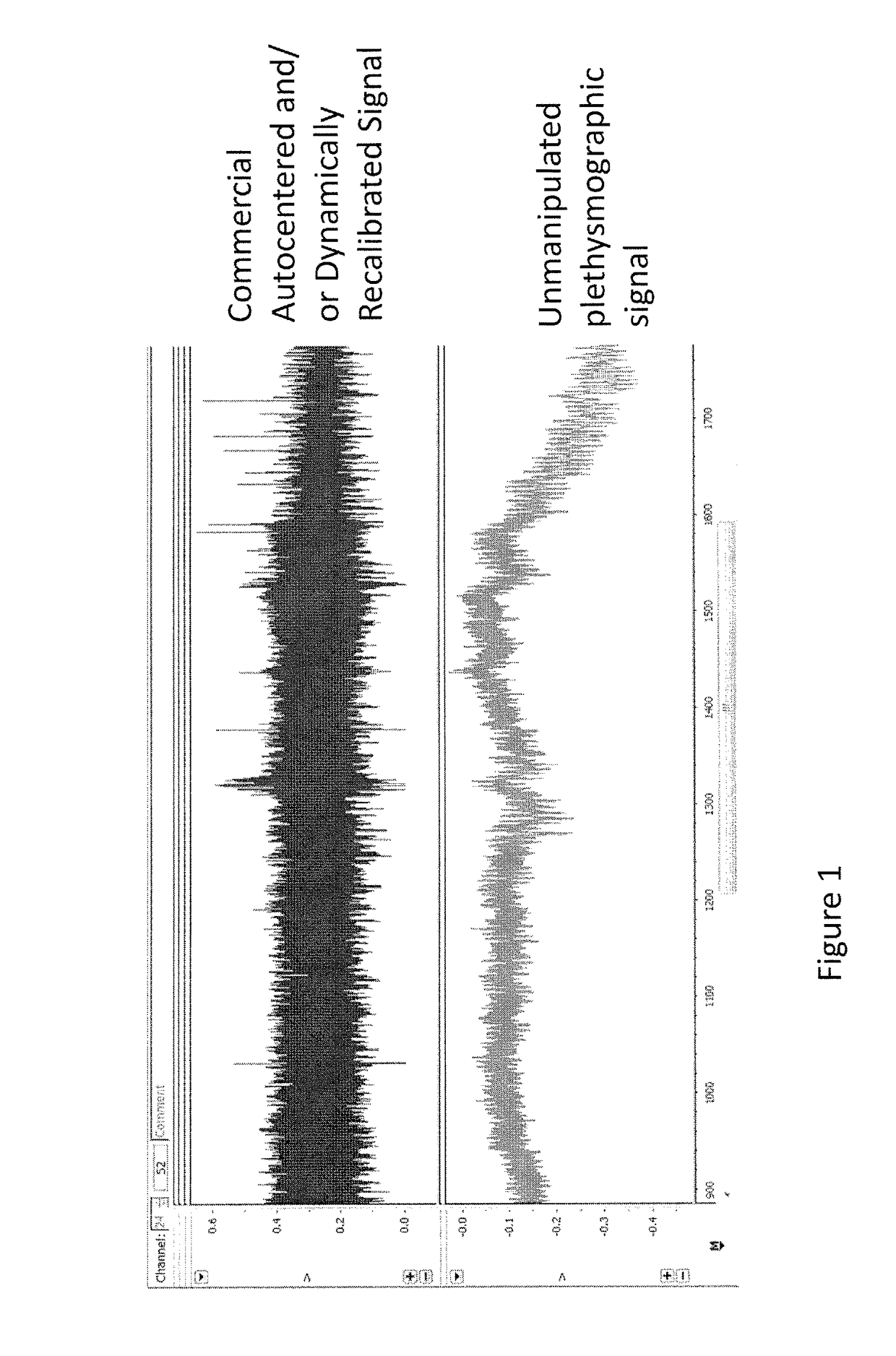 Method and system enabling photoplethysmograph measurement of volume status