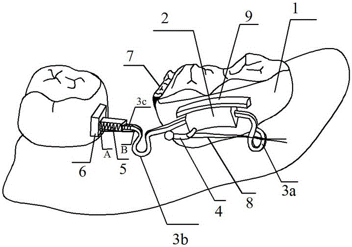 Gap recovering and holding device