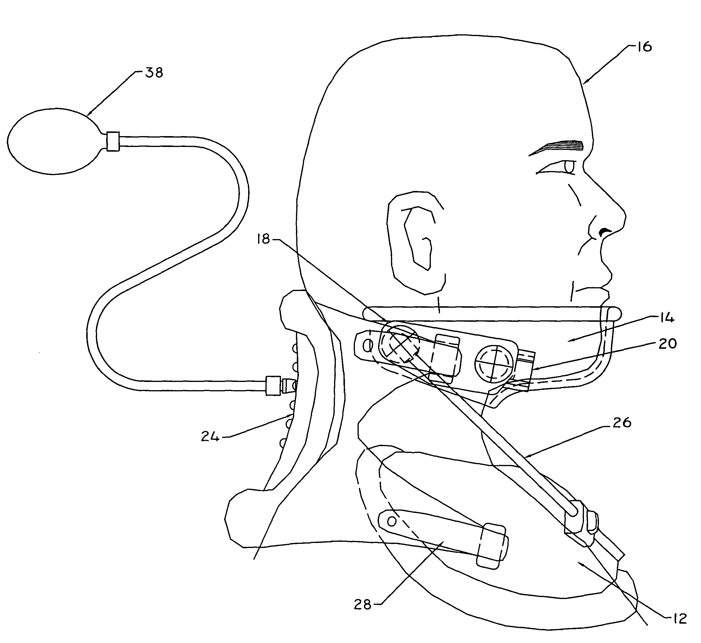 Forward head posture correction collar