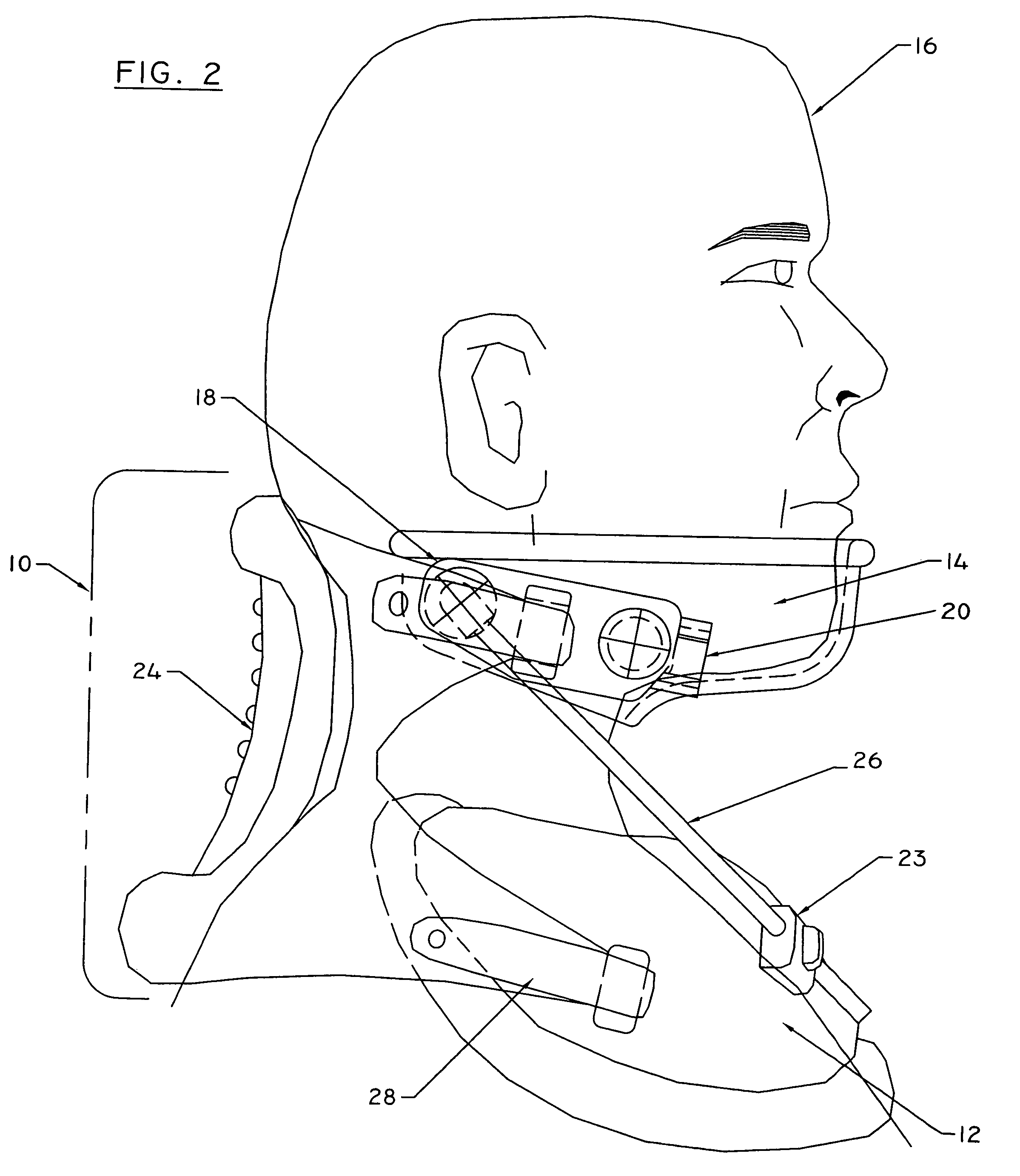 Forward head posture correction collar