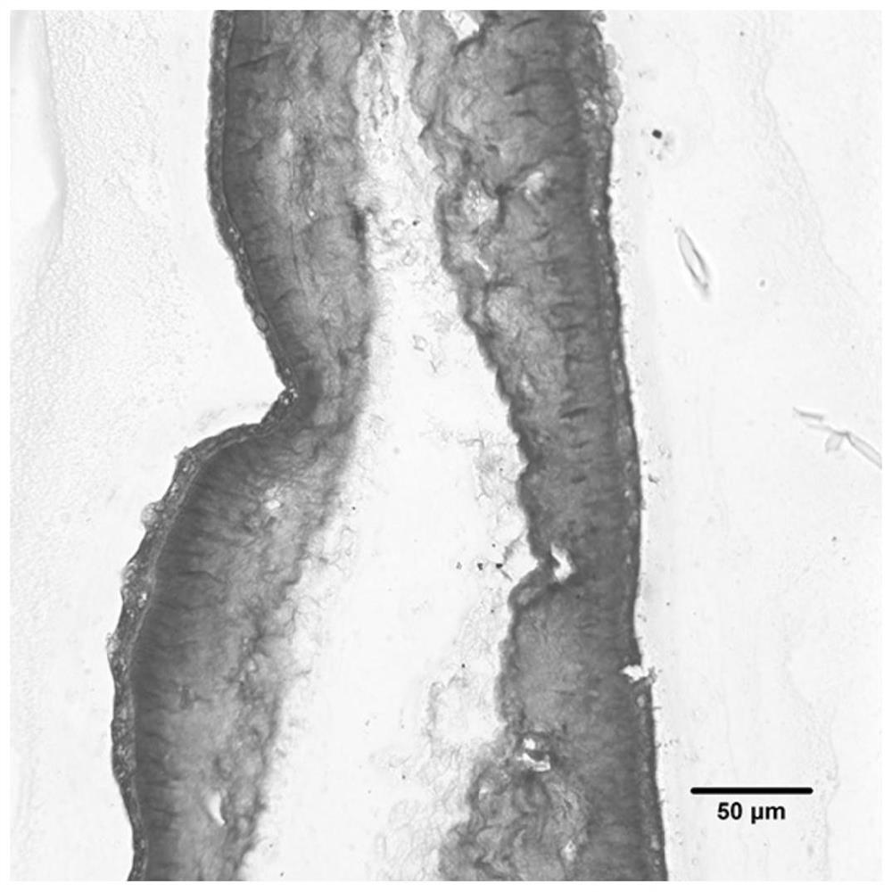 A kind of decellularized biological amniotic membrane comprising loose layer and preparation method thereof