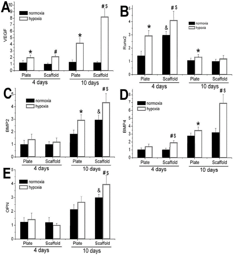 Bionics-based preparation method for tissue-engineered bone