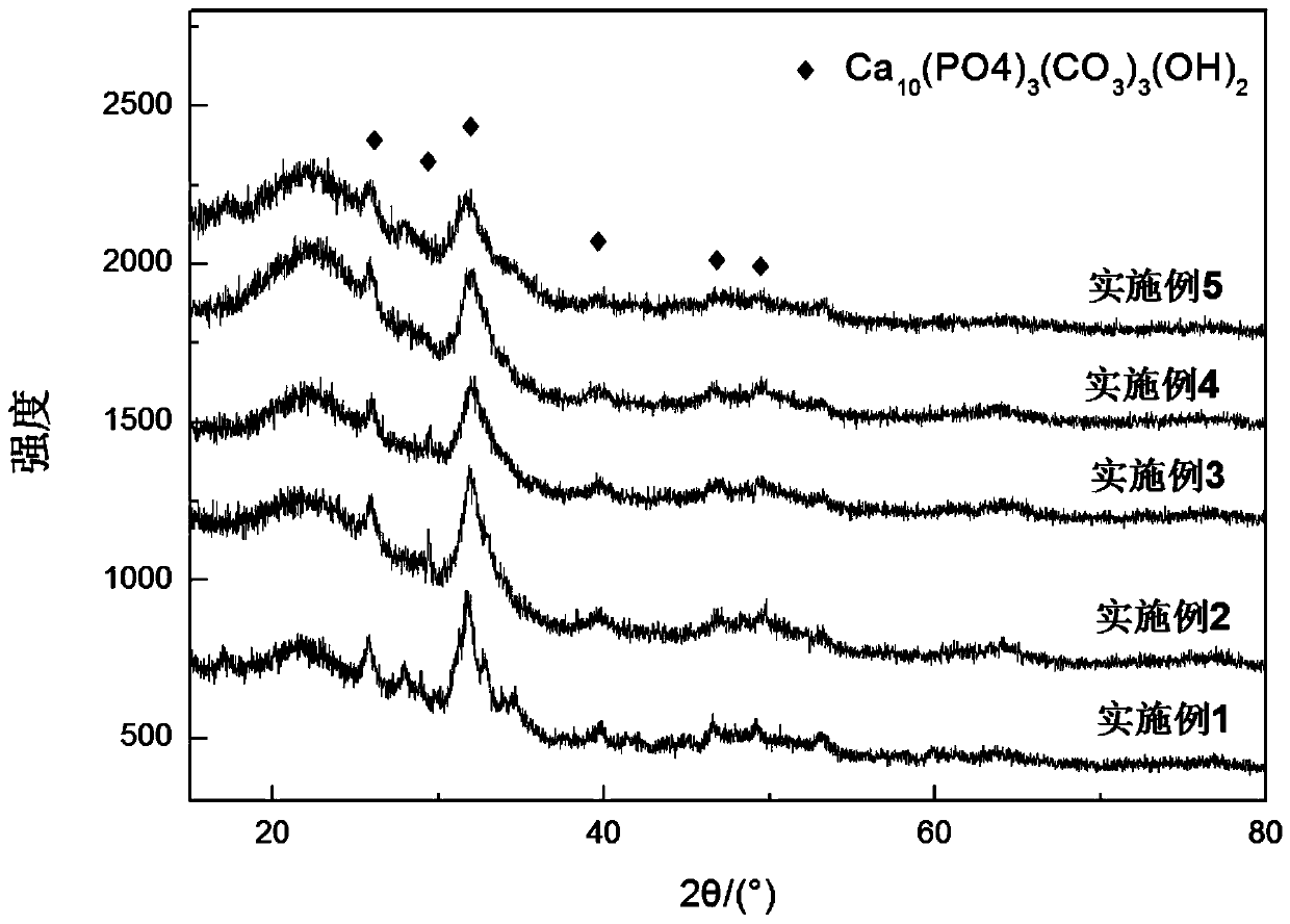 Bone cement based on bio-based polyurethane composite degradable material and preparation method thereof