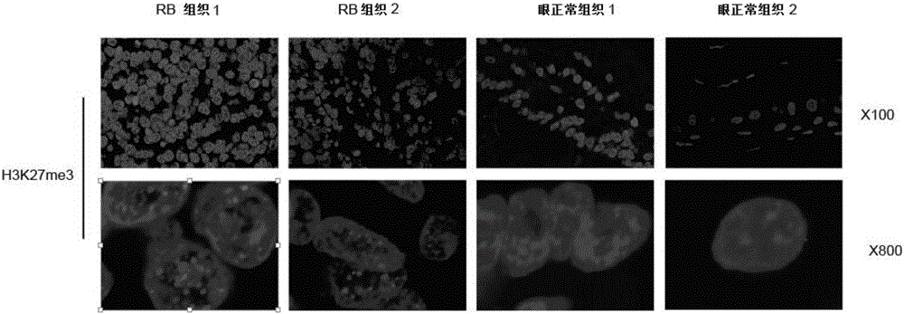 Application of GSK503 in preparing drug for treating RB (Retinoblastoma)