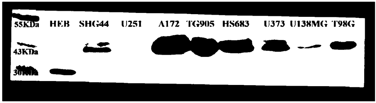 Human HLA-F monoclonal antibody as well as preparation method and application thereof