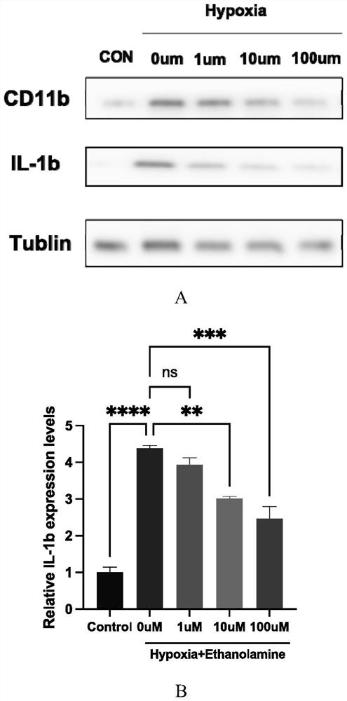 Application of ethanolamine in preparation of product for preventing, relieving and/or treating neuroinflammation-related diseases