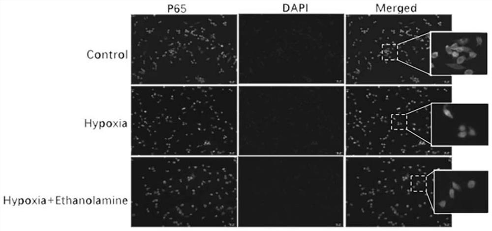 Application of ethanolamine in preparation of product for preventing, relieving and/or treating neuroinflammation-related diseases