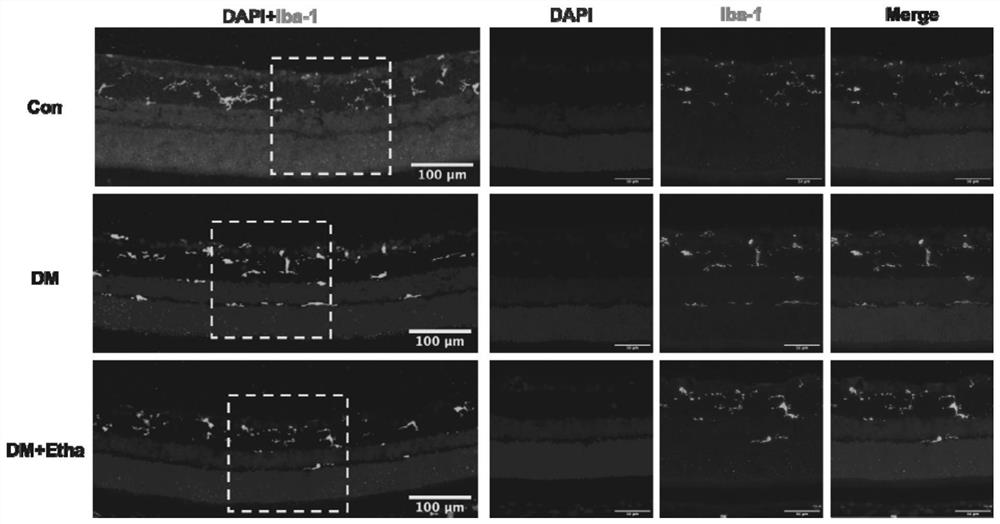 Application of ethanolamine in preparation of product for preventing, relieving and/or treating neuroinflammation-related diseases