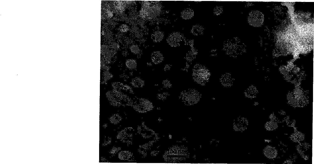 Lipid nano granule containing magnetic resonance contrast agent as well as preparation method and use thereof