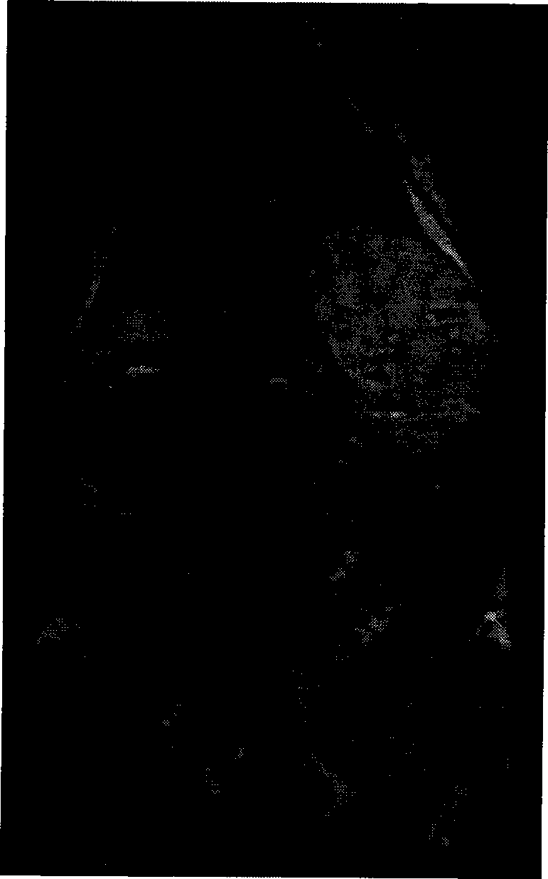 Lipid nano granule containing magnetic resonance contrast agent as well as preparation method and use thereof