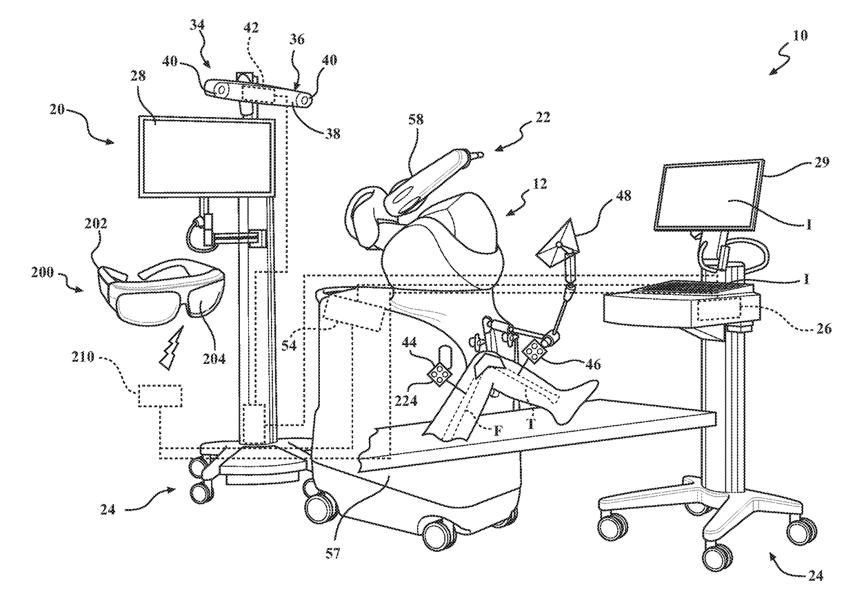 Systems And Methods For Surgical Navigation