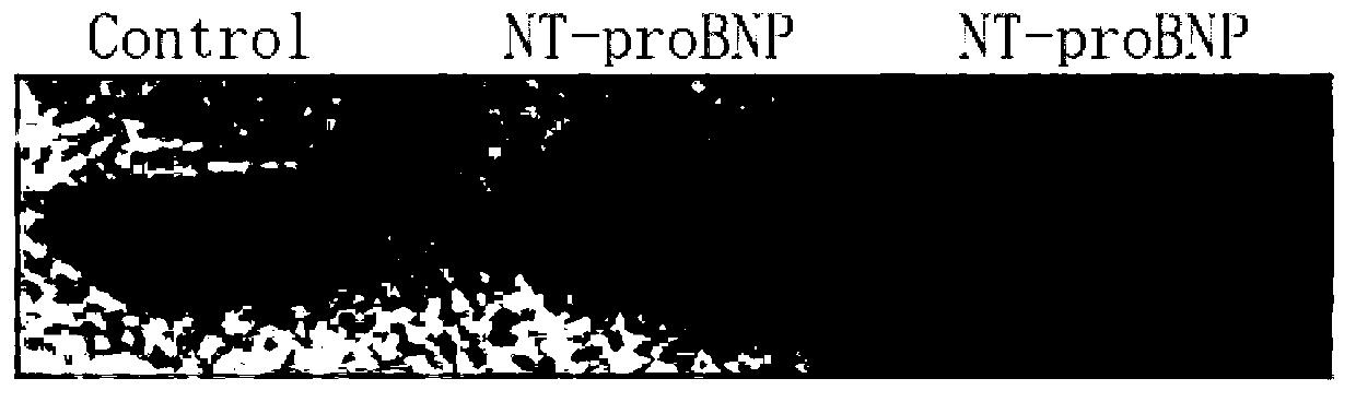 B cell epitope peptide segment of amino-terminal pro-brain natriuretic peptide and applications thereof