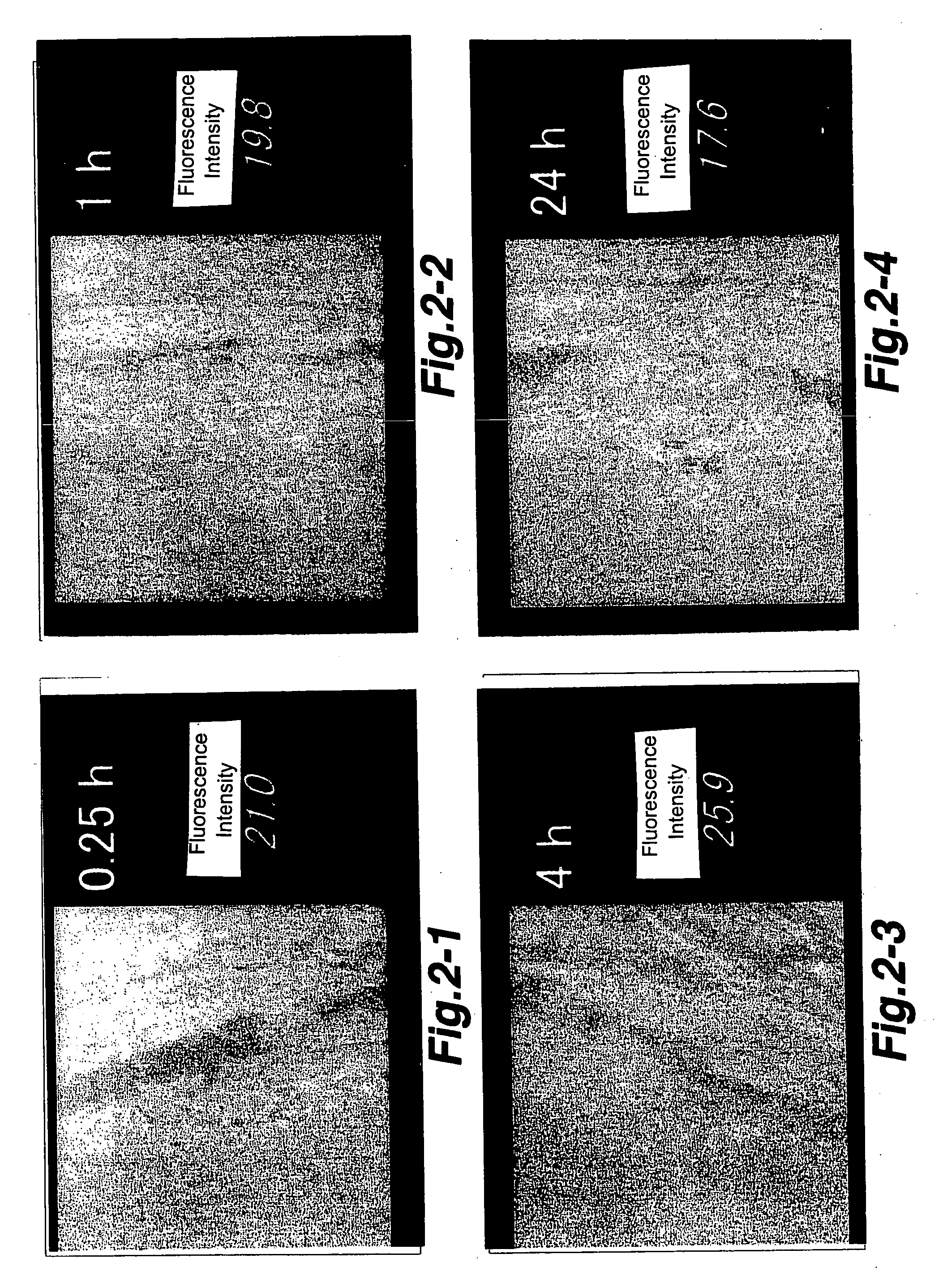 Ophthalmic drug delivery system using polymer micell