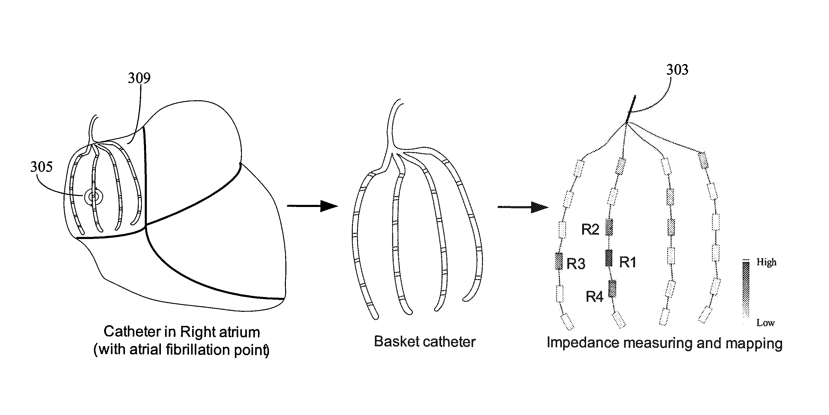 System for characterizing patient tissue impedance for monitoring and treatment