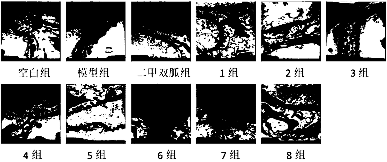 Pharmaceutical composition to prevent and treat diabetic nephropathy and preparation method thereof