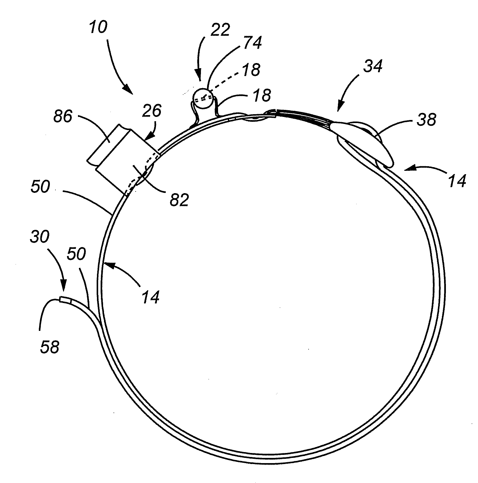 Tourniquet and method of use