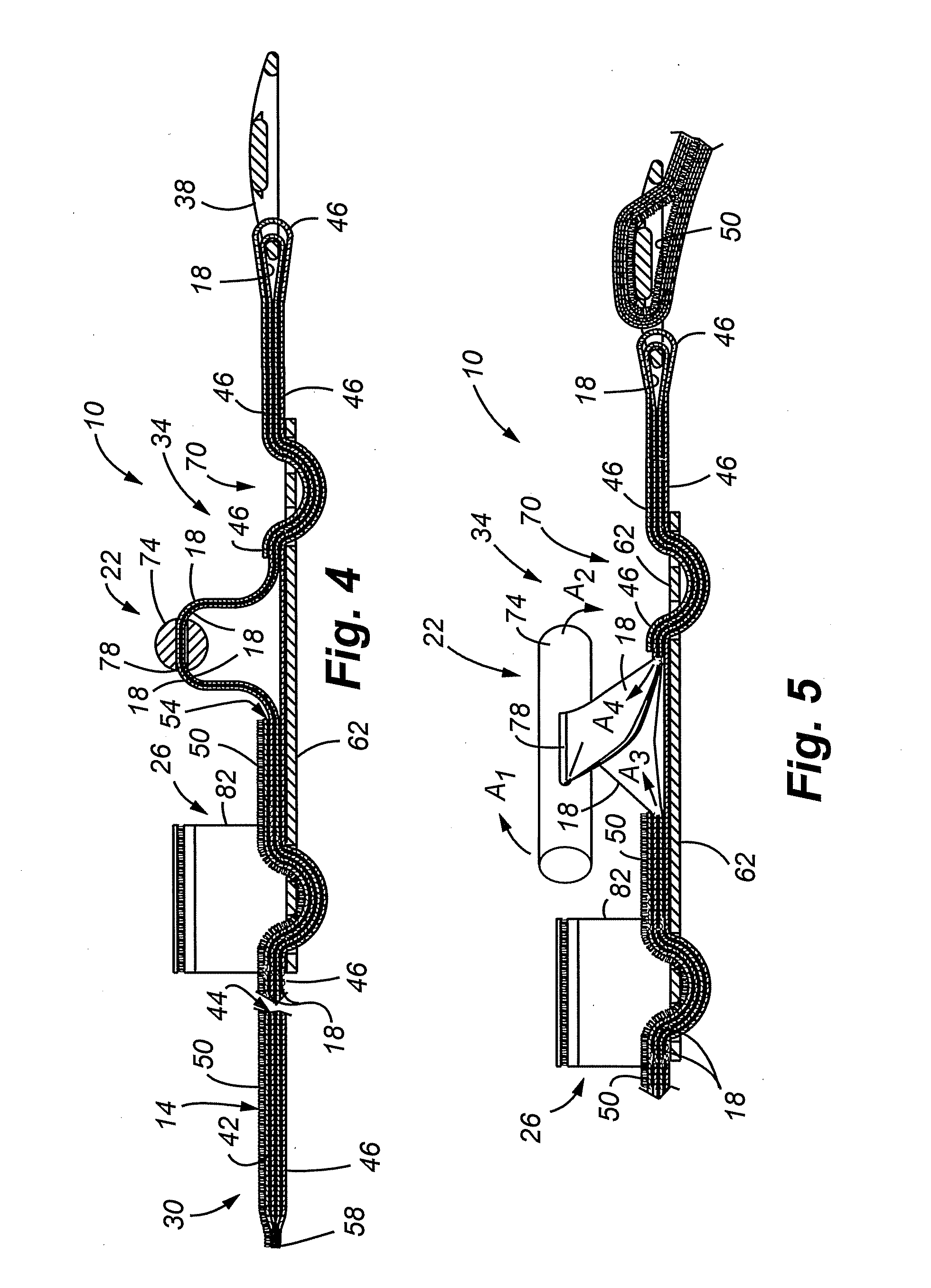 Tourniquet and method of use