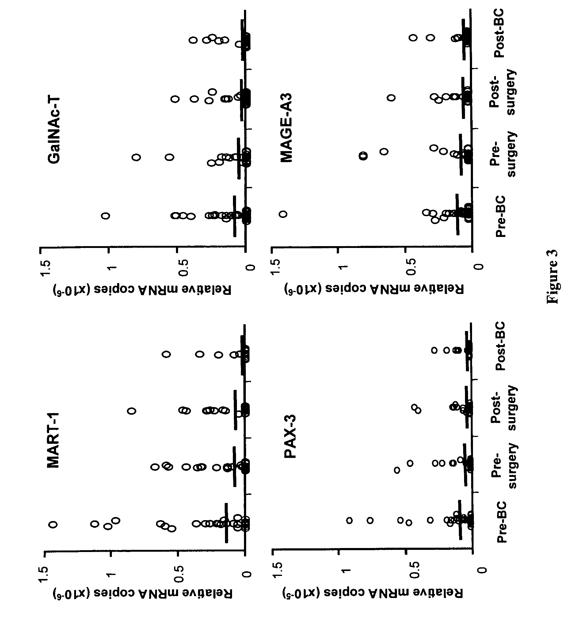 Detection of cancer cells in body fluids