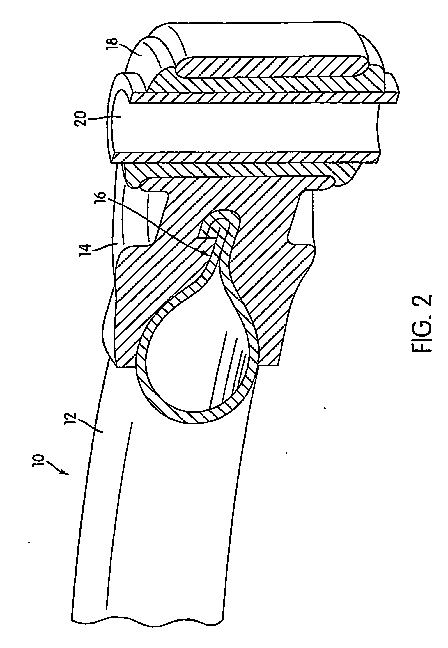 Hybrid Component