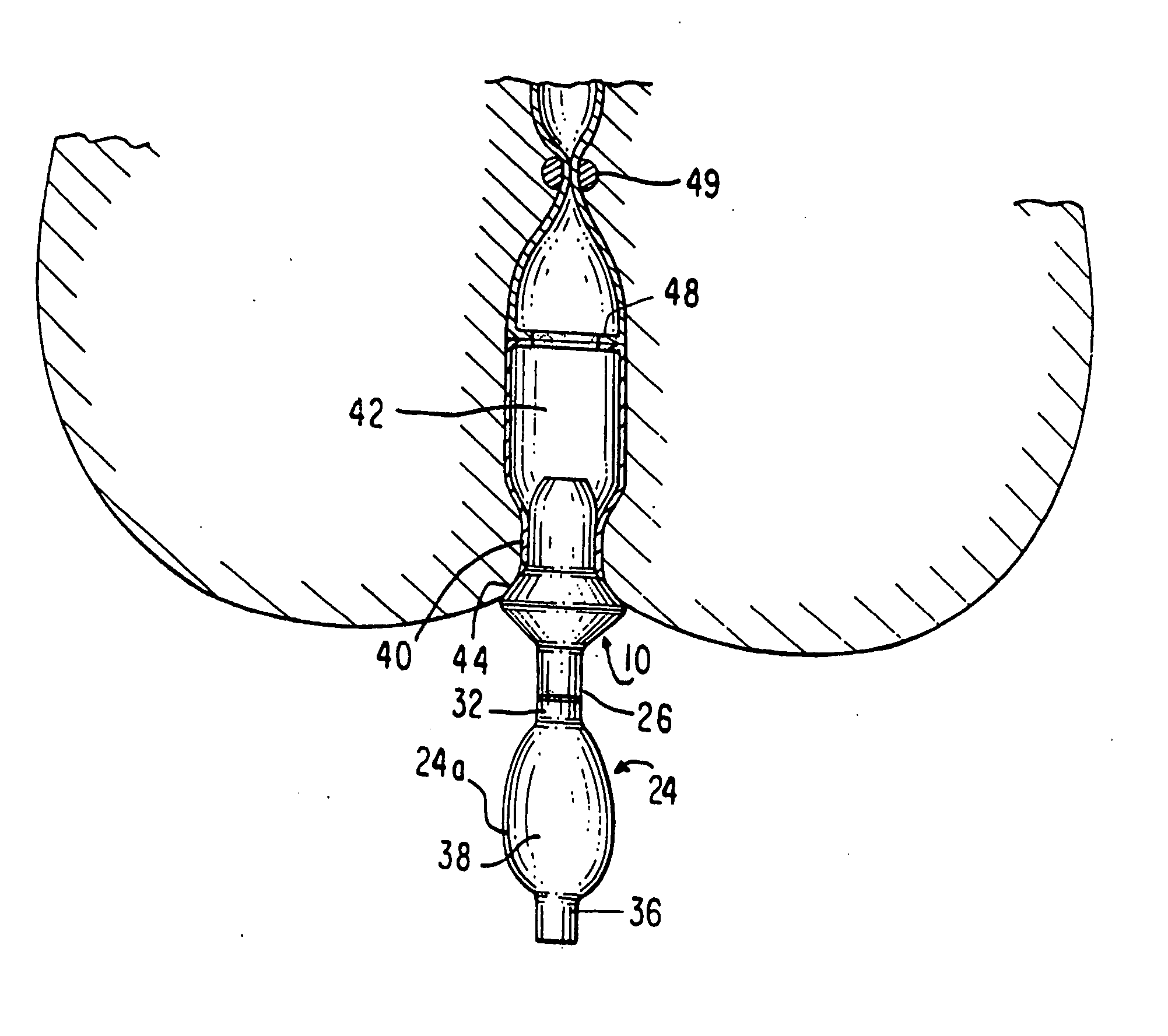 Anastomotic leak testing apparatus