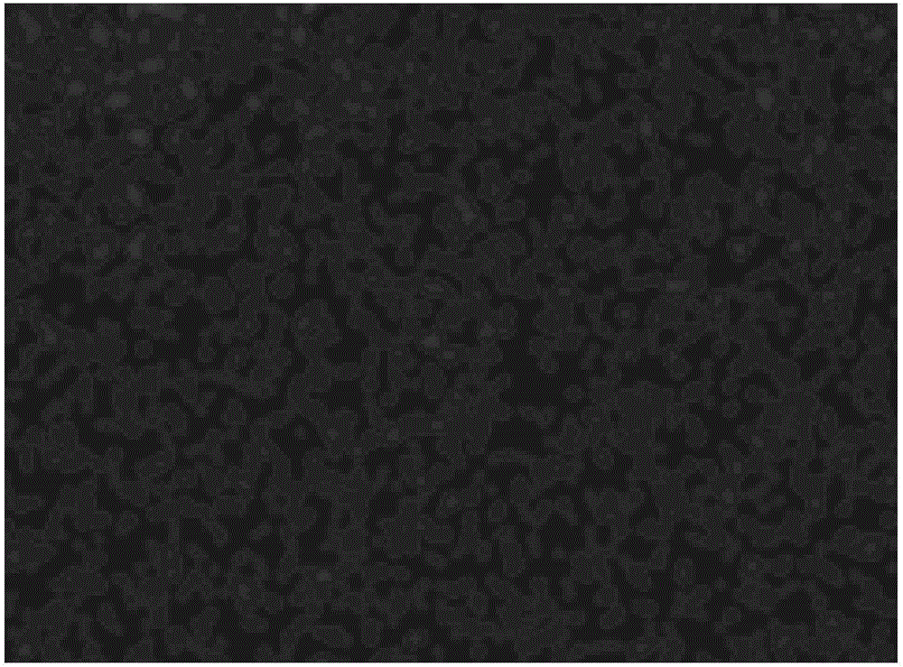 Preparation method of boron nitride and aluminum nitride co-doped high-heat-conduction and high-insulation polyimide composite thin film