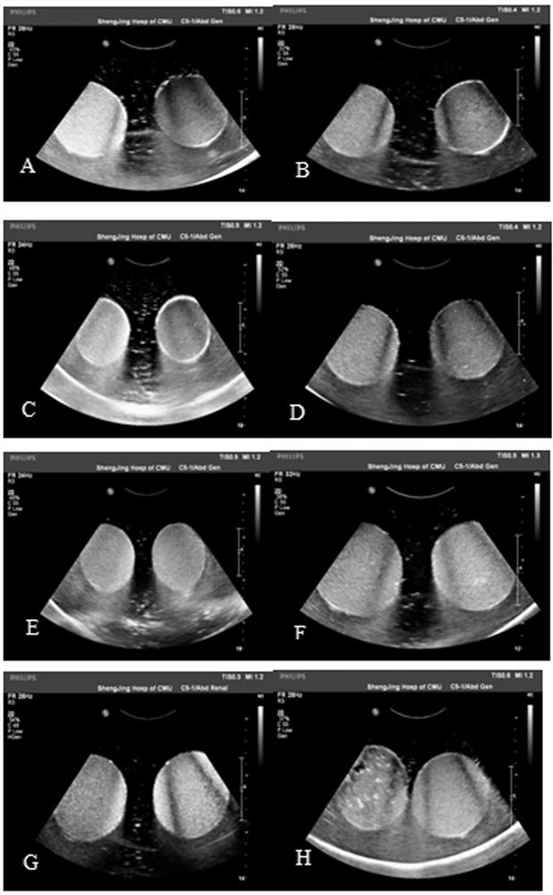 A ready-to-use liquid oral gastric ultrasound contrast agent formula and preparation method