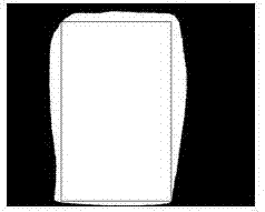 Vein recognition method based on texture features