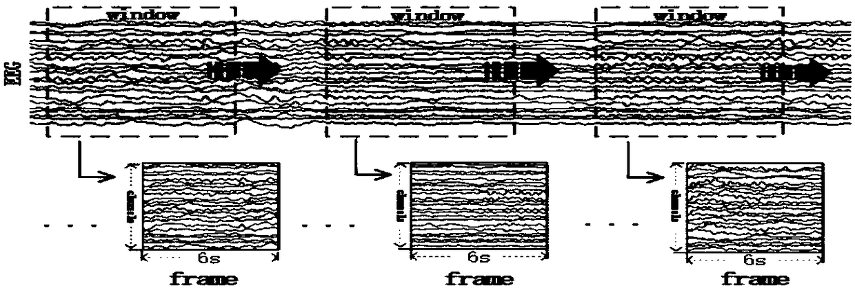 Long-term-electroencephalogram automatic epilepsy detection method based on convolutional neural network