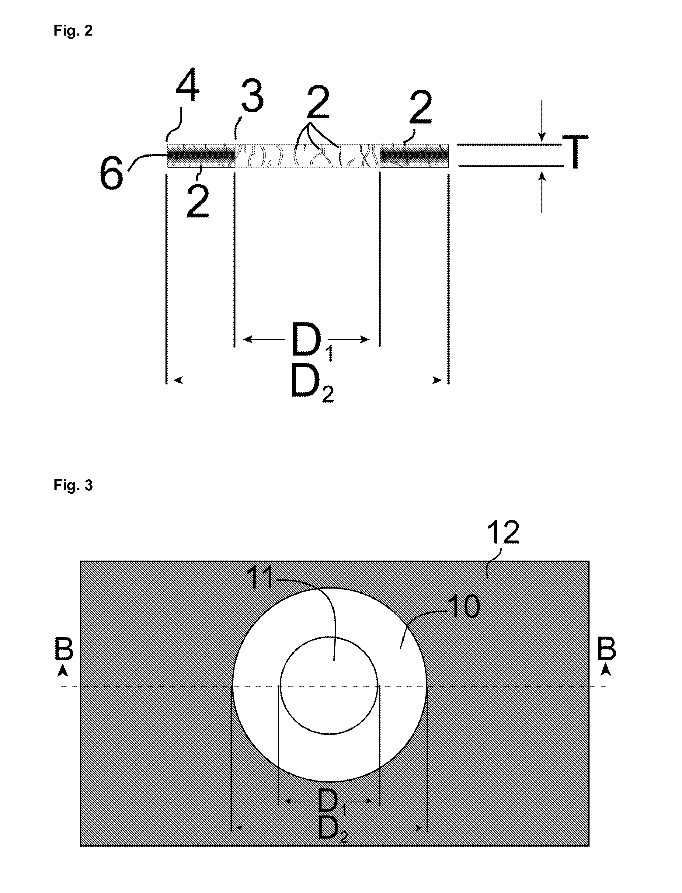 Corneal implants produced by irradiation of polymer films