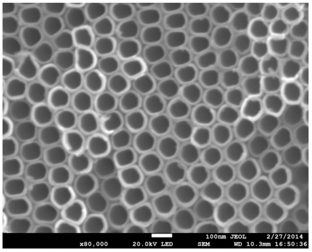 Medical titanium metal implant material and preparation method thereof