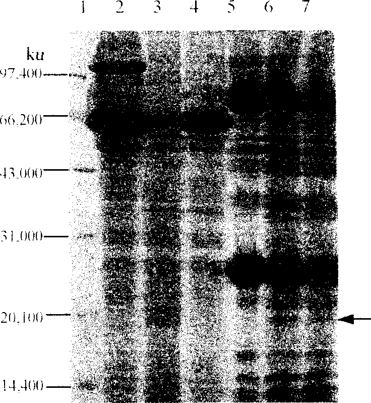 Method for using silkworm to express human interleukin 11 to produce medicine