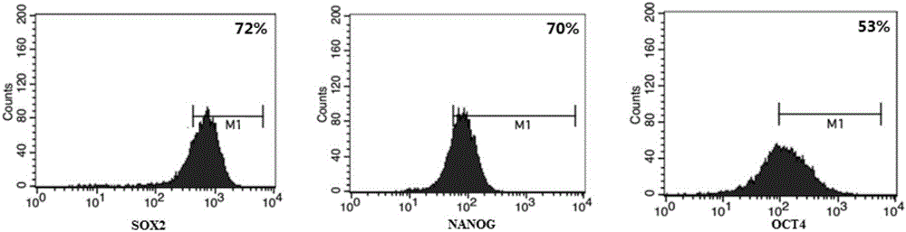 Preparation method of human breast milk stem cells and application of human breast milk stem cells