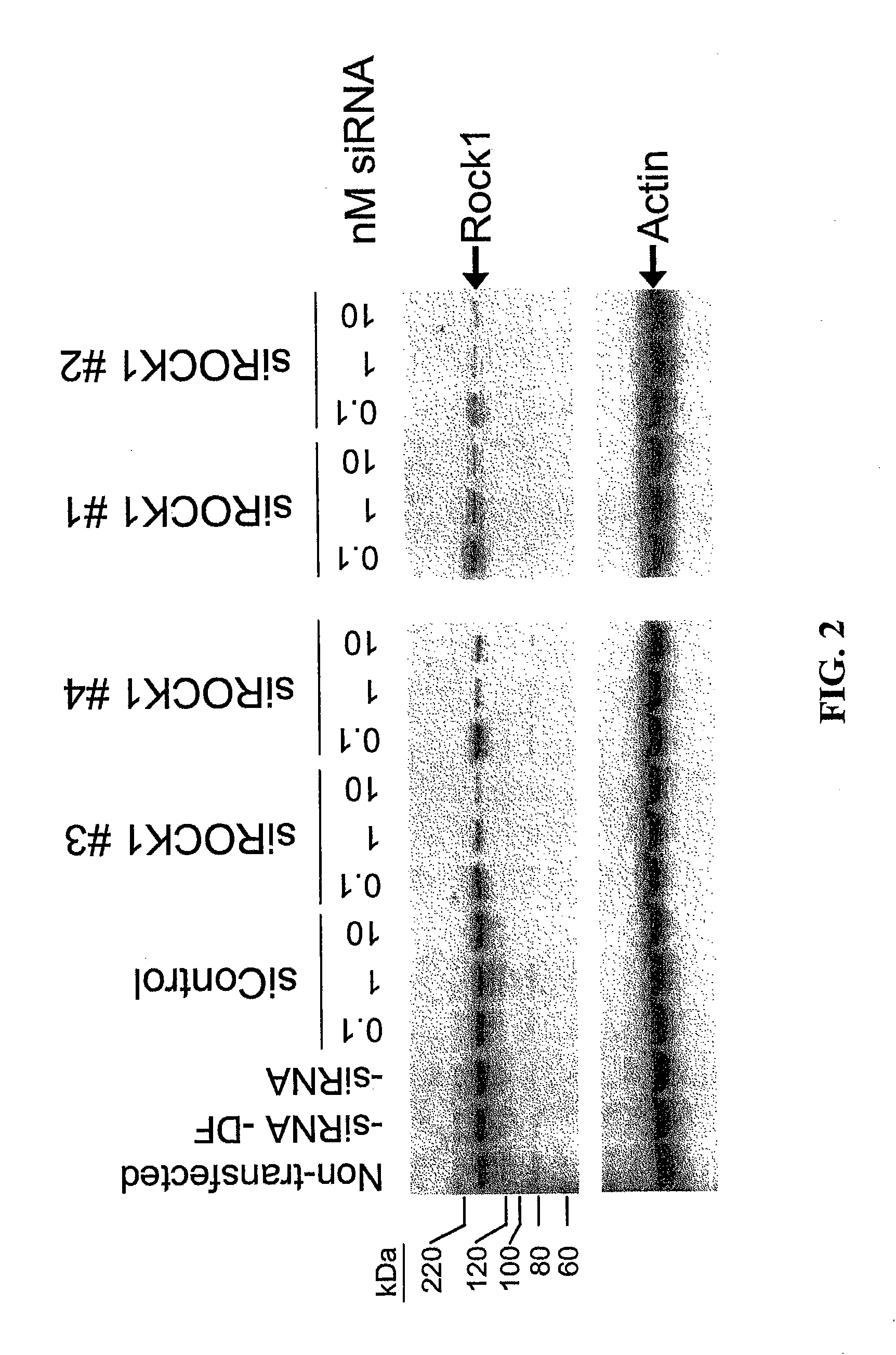 RNAi-Mediated Inhibition of RHO Kinase for Treatment of Ocular Disorders