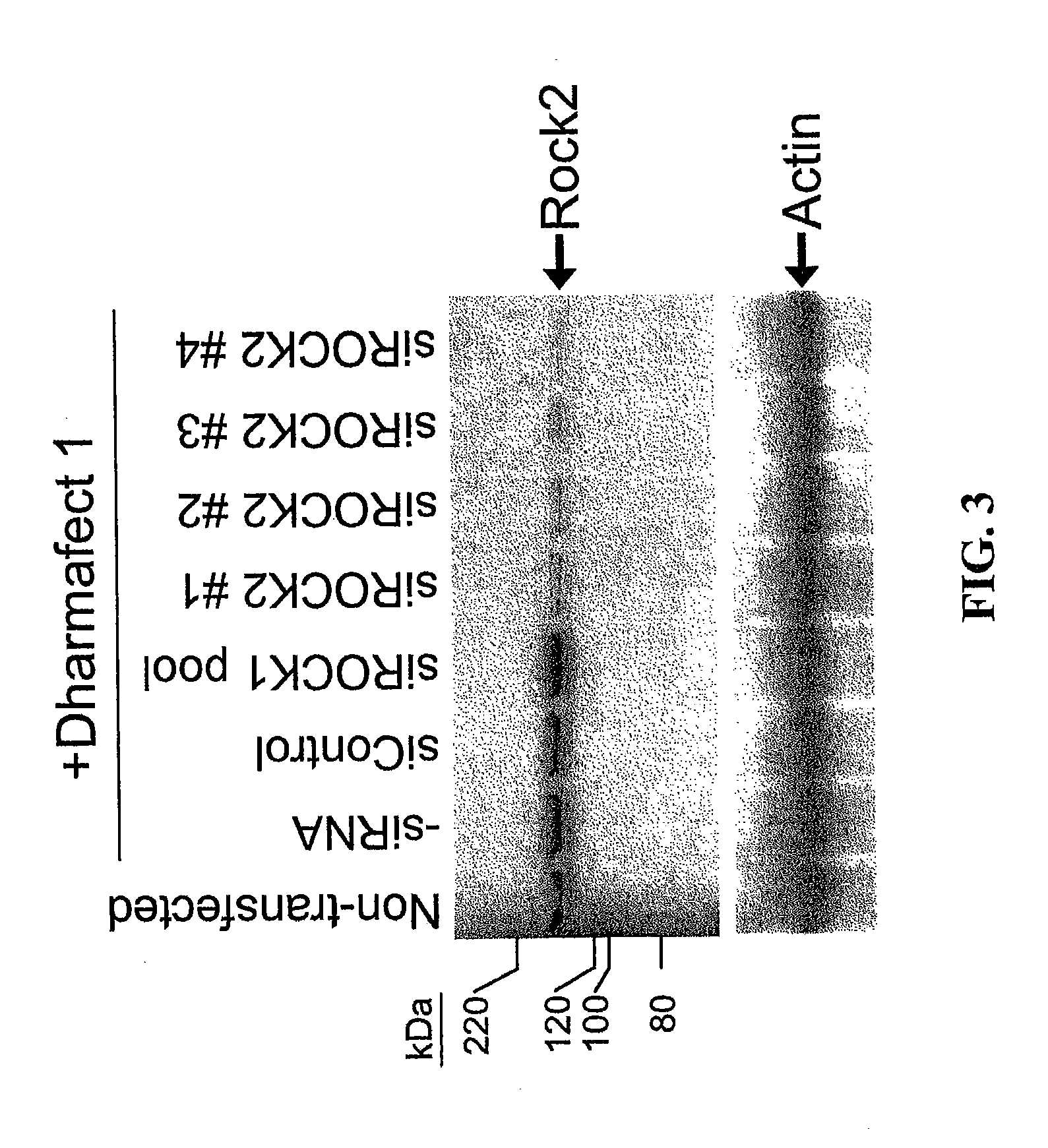 RNAi-Mediated Inhibition of RHO Kinase for Treatment of Ocular Disorders