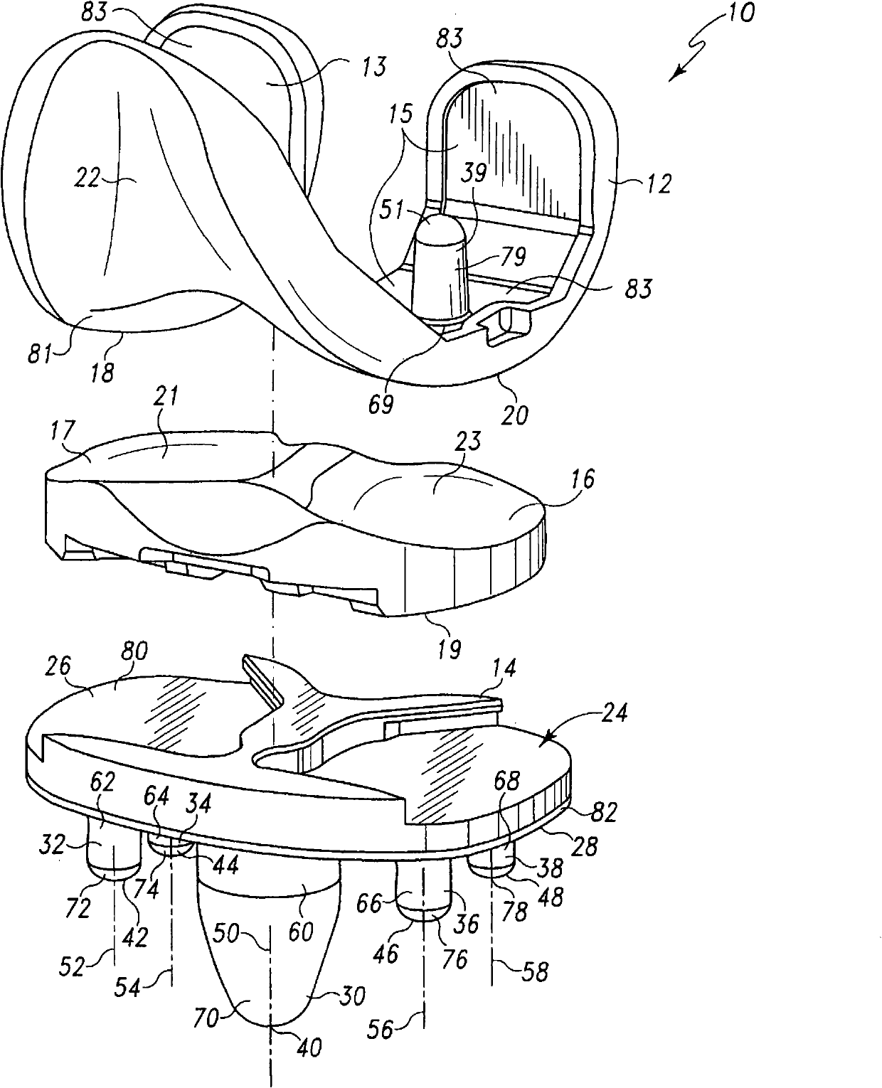 Prosthesis for cemented fixation and method for making the prosthesis