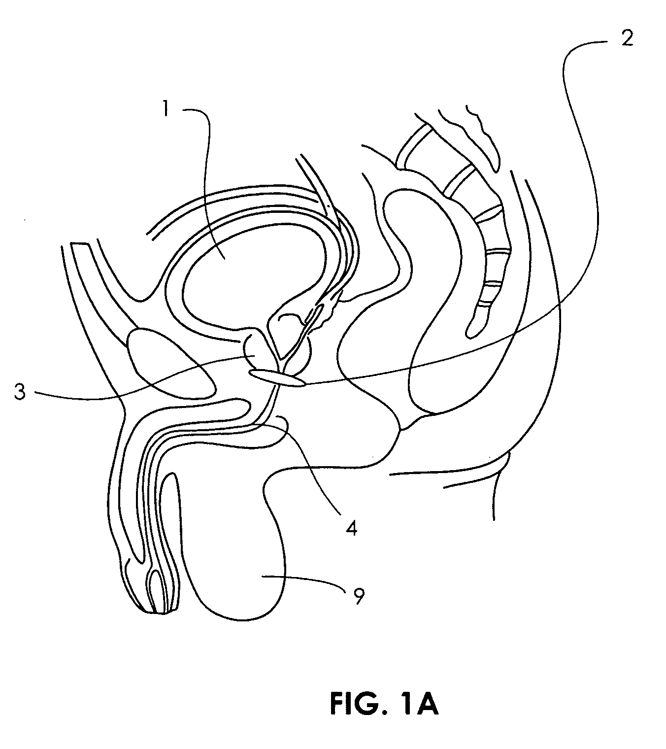 Artificial sphincter with piezoelectric actuator