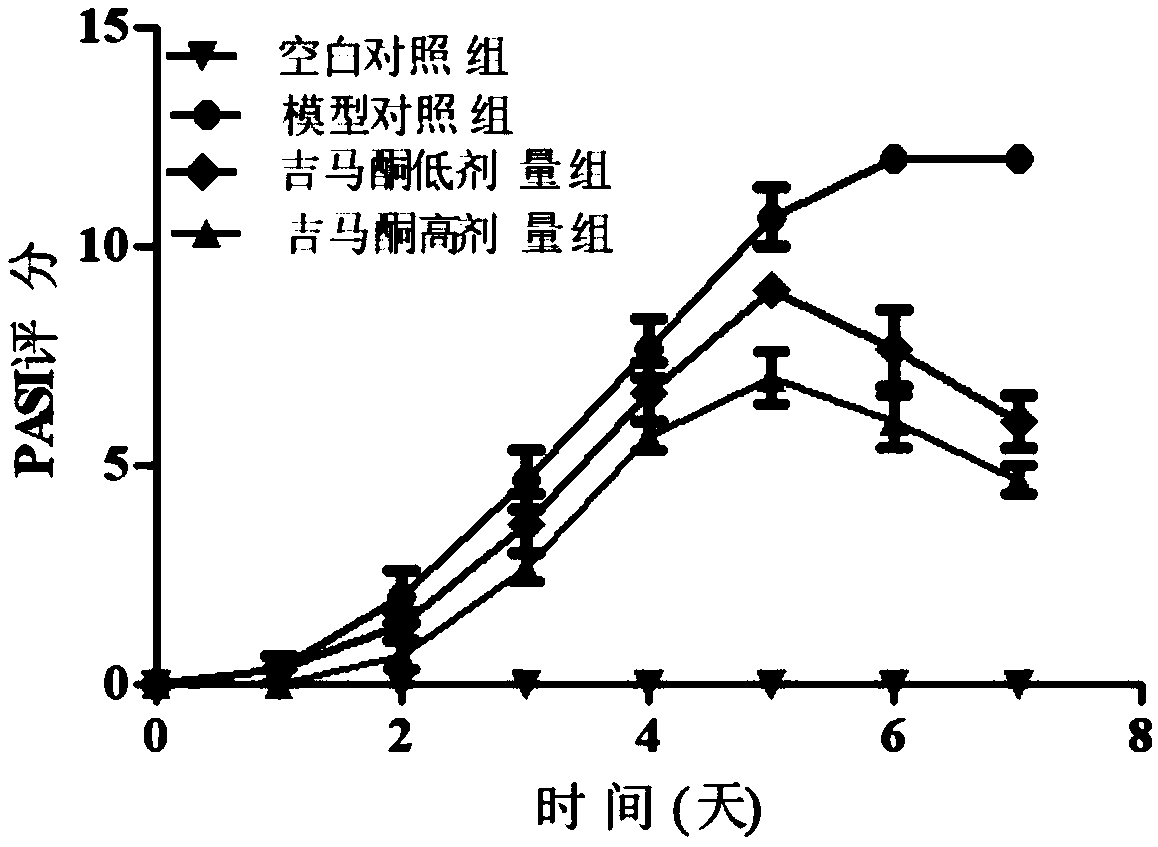 Application of germacrone in preparation of medicines for preventing and treating psoriasis