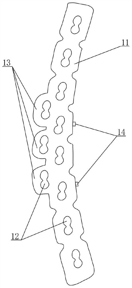 An anatomical plate system for quadrilateral fractures of the anterior column of the acetabulum