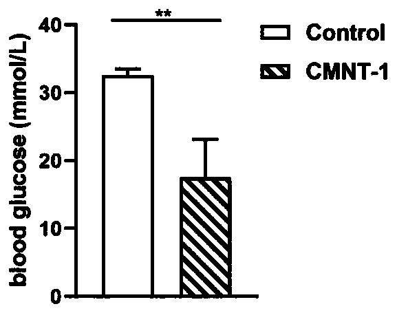 Diabetes treatment composition based on traditional Chinese medicine nutritional therapy and application thereof