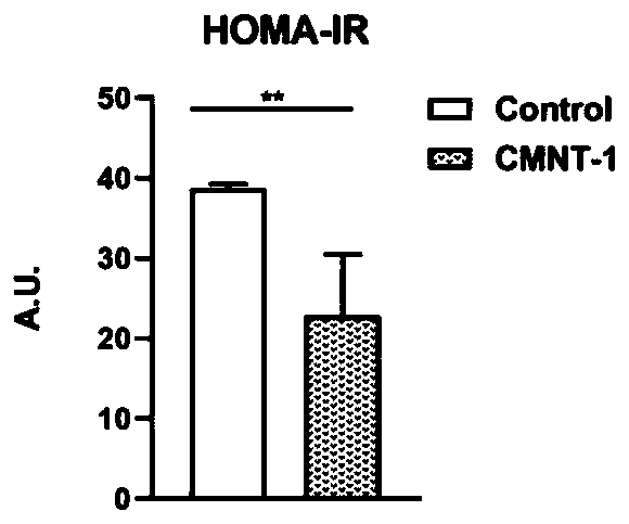 Diabetes treatment composition based on traditional Chinese medicine nutritional therapy and application thereof