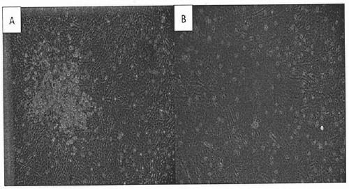 Recombinant turkey herpesvirus expressing HA gene and application thereof