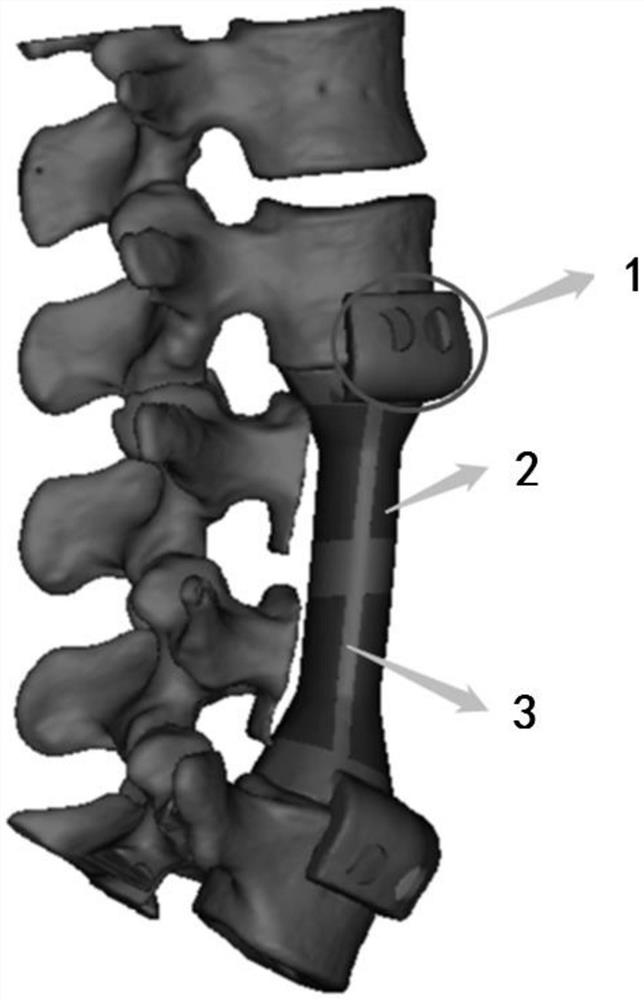 Vertebral prosthesis