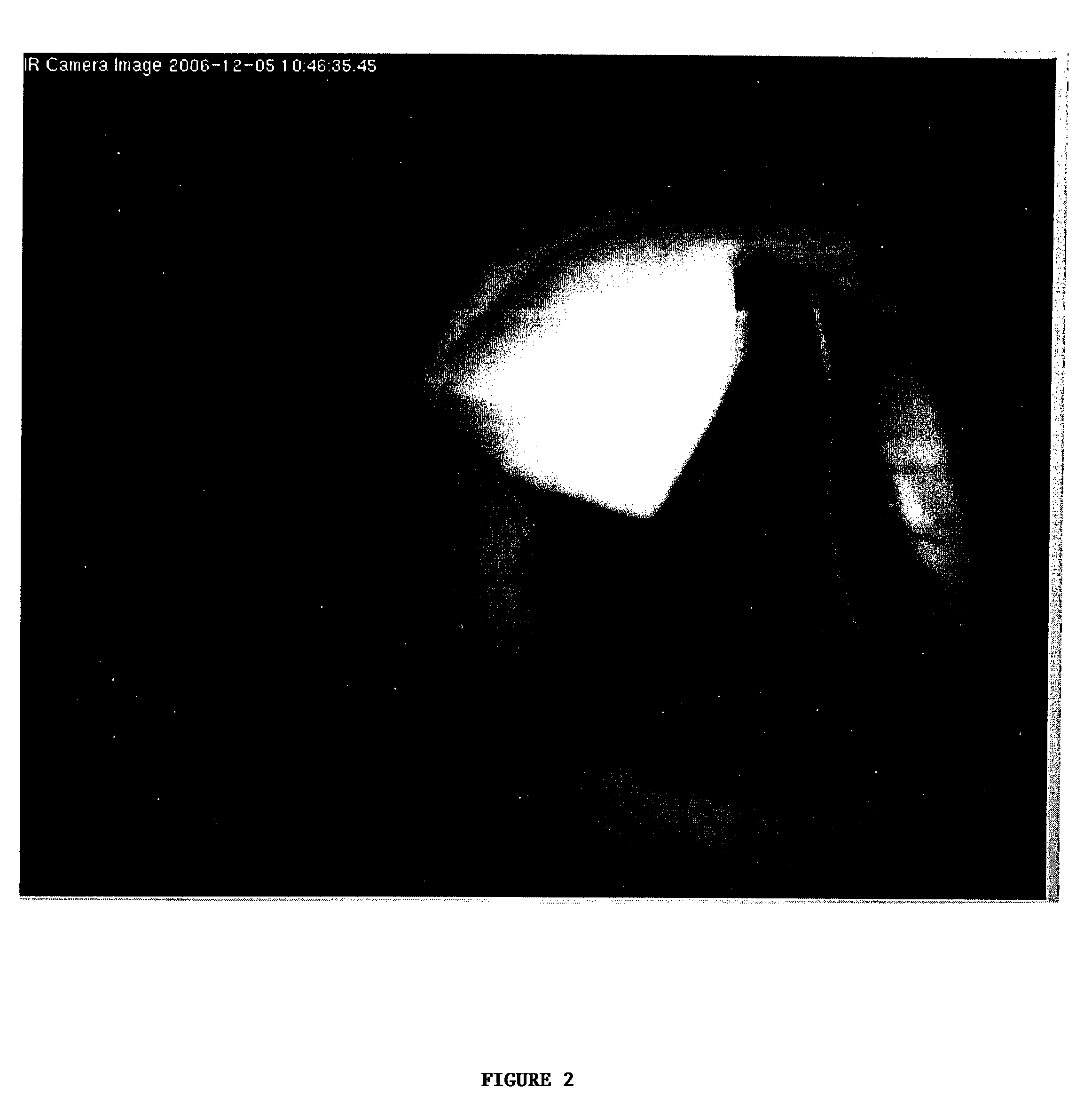 Intraoperative Imaging Of Hepatobiliary Structures