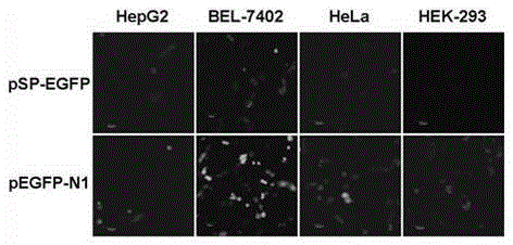 Construction and Application of Recombinant Adenoviral Vector of Survivin Promoter Regulating cd Gene