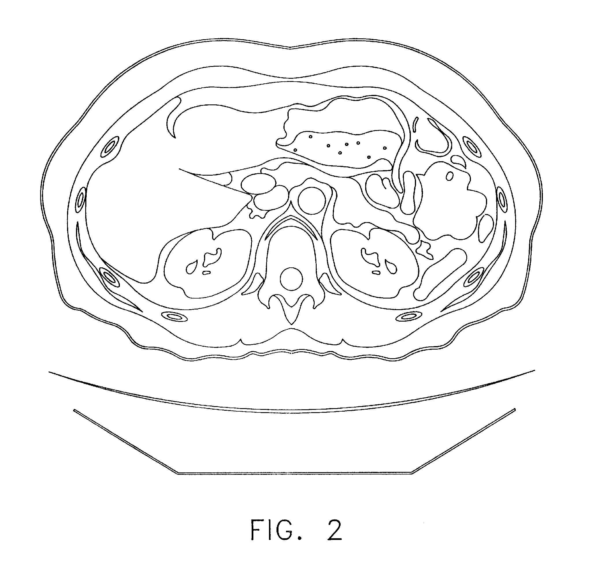 Anatomical visualization and measurement system